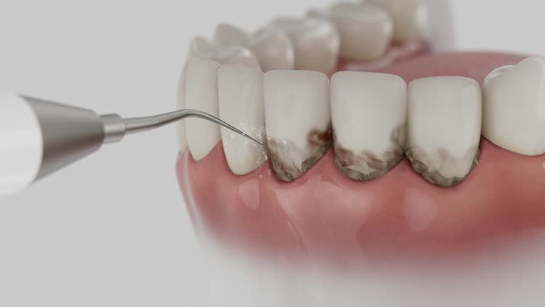 Trusted Invisalign Clear Aligners service in Leesville, LA - Dentist Open Now